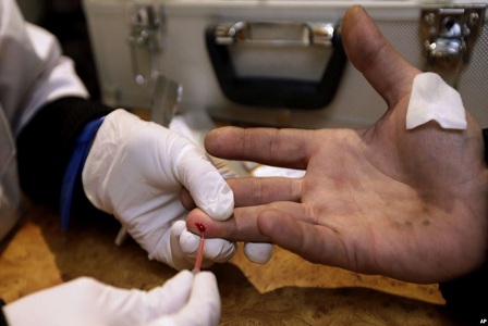 Para Ilmuwan Lakukan Tes Baru Temukan HIV yang Tersembunyi
